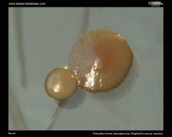 staph and pseudomonas colony morphology